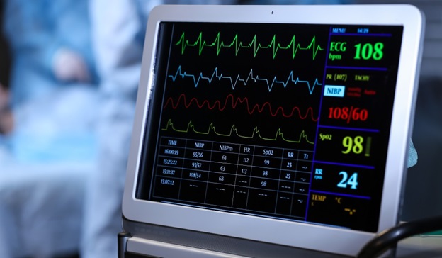 ECG