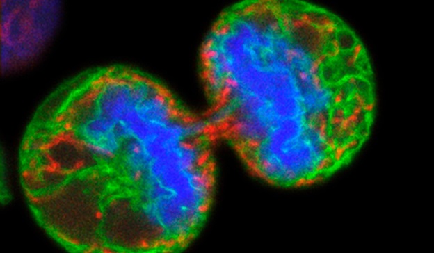 Human melanoma cell dividing. Paul J.Smith &Rachel Errington. Attribution 4.0 International (CC BY 4.0). Source: Wellcome Collection.
