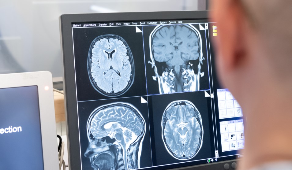 clinicians reviewing an MRI