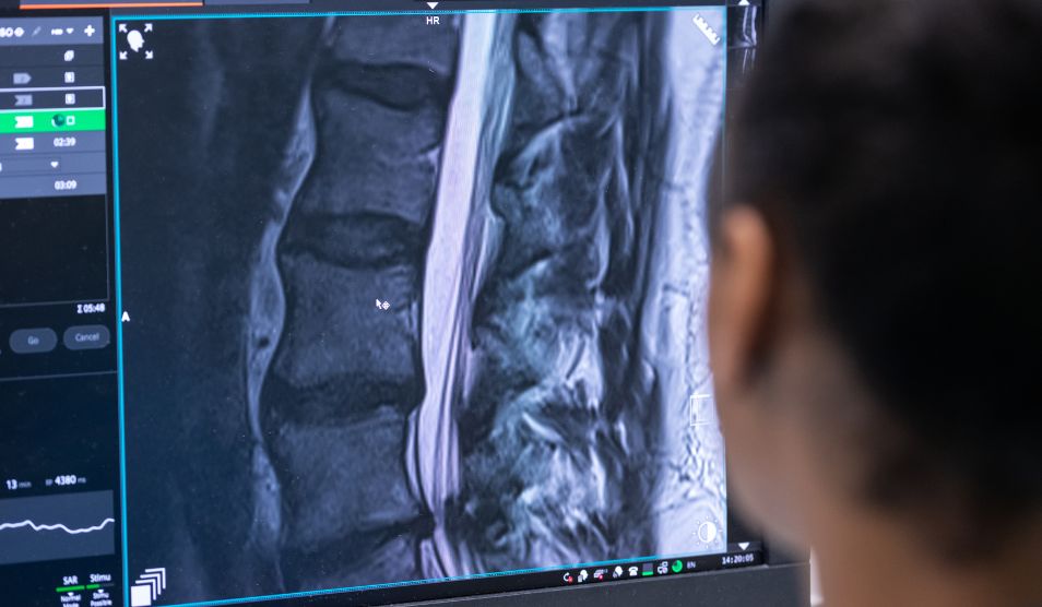 Member of staff examines a detailed MRI scan of the spine on a computer screen, focusing on the vertebrae and surrounding tissues