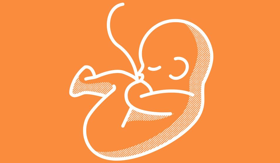 Labour wards Labour wards