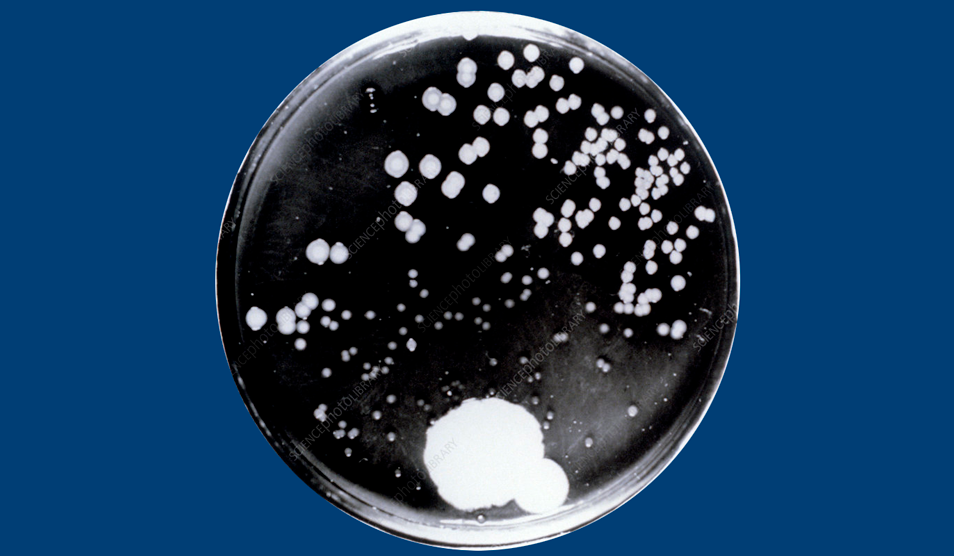 Alexander Fleming culture plate