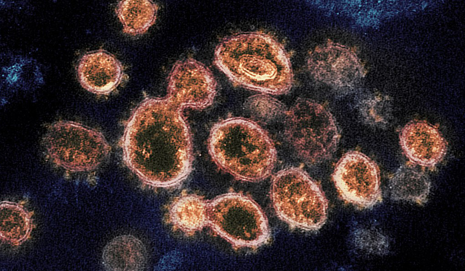 This transmission electron microscope image shows SARS-CoV-2, the virus that causes COVID-19, isolated from a patient in the U.S. Credit: NIAID-RML