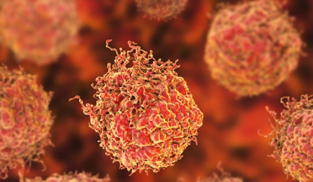 Imperial researchers awarded £1.3 million to fight prostate cancer