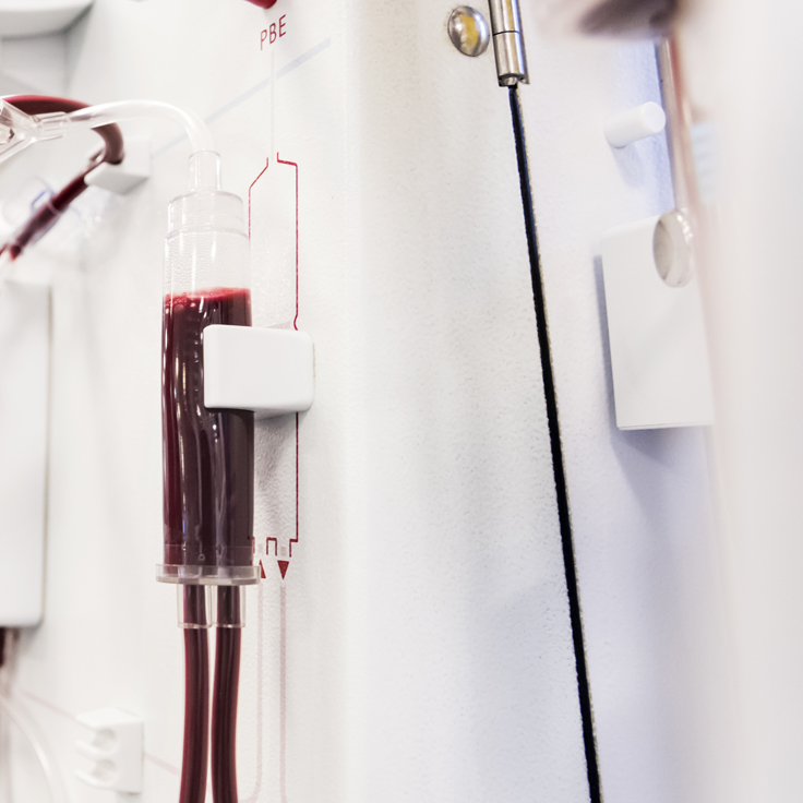 Bone-marrow-transplants2