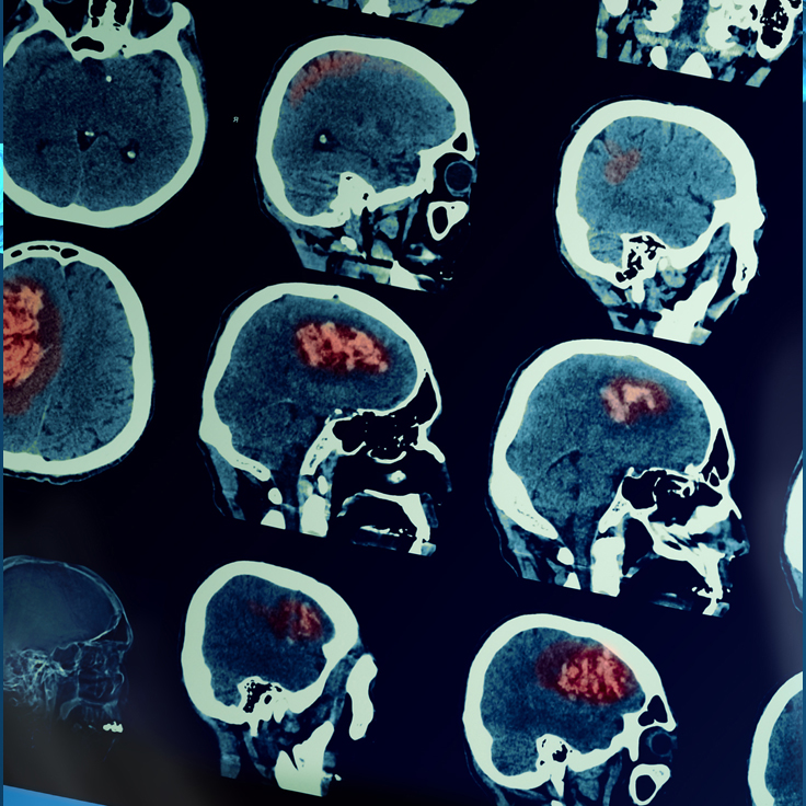 CT scan1