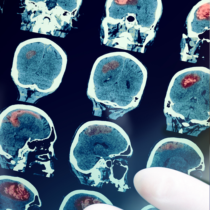 CT scan2