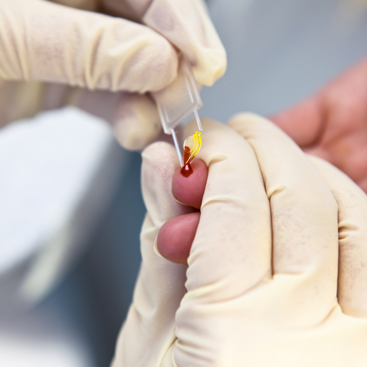 Blood prick test