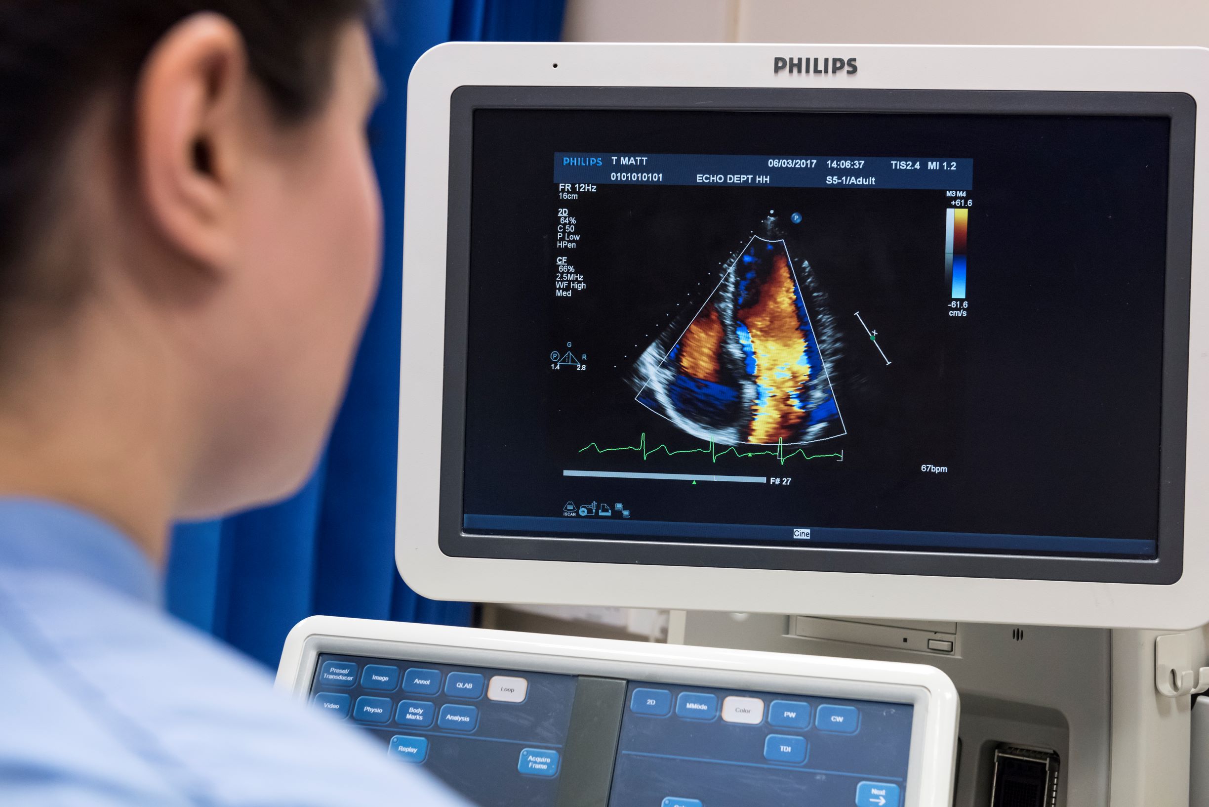Echocardiography: Imperial College London postgraduate students practicing ultra sound techniques at Hammersmith Hospital. 