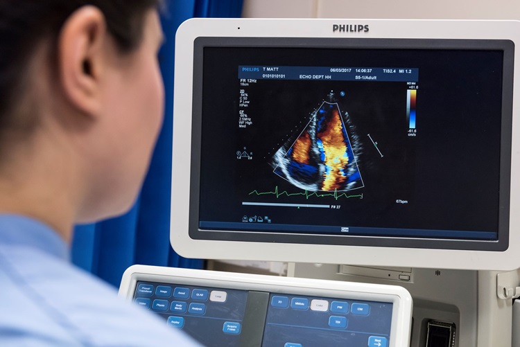 Echocardiography: Imperial College London postgraduate students practicing ultra sound techniques at Hammersmith Hospital.