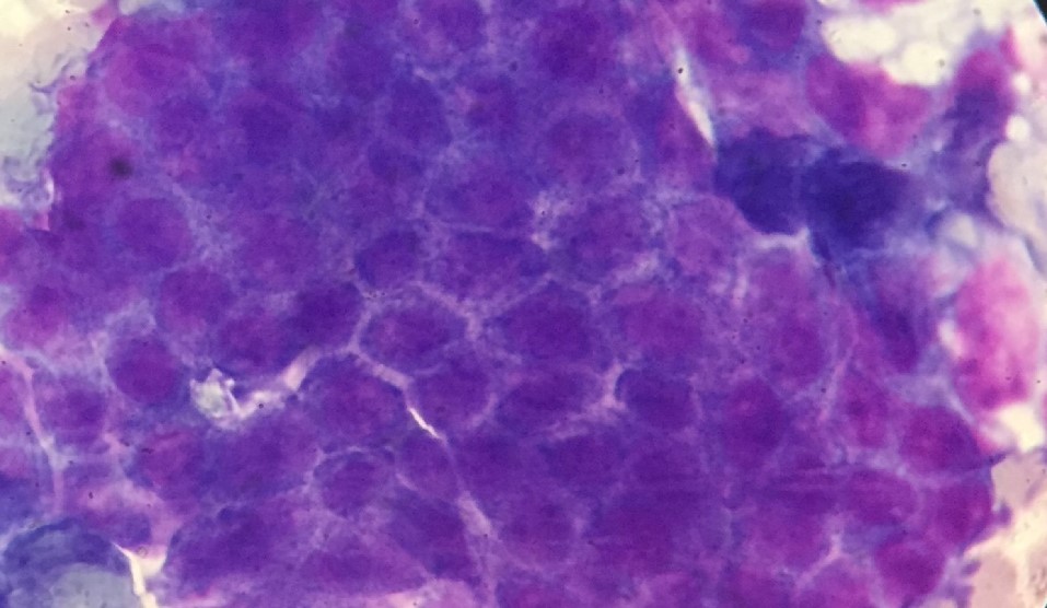 Imperial College Healthcare Nhs Trust Mri Tool That Can Diagnose Difficult Cases Of Ovarian Cancer To Be Tested At The Trust