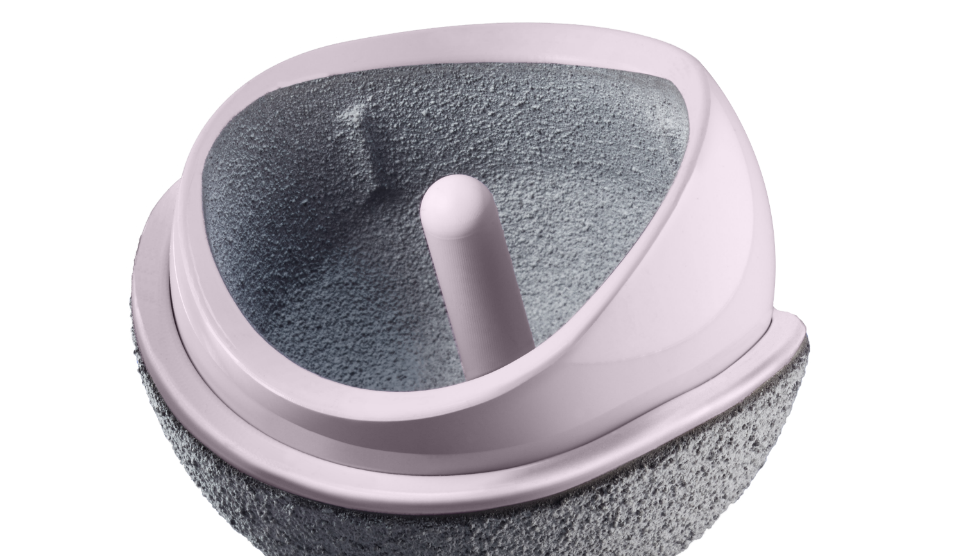 Imperial College Healthcare Nhs Trust New Hip Resurfacing Implant Could Lead To Better Outcomes For Patients